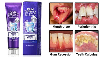 Bee Venom Toothpaste for Sensitive Gums