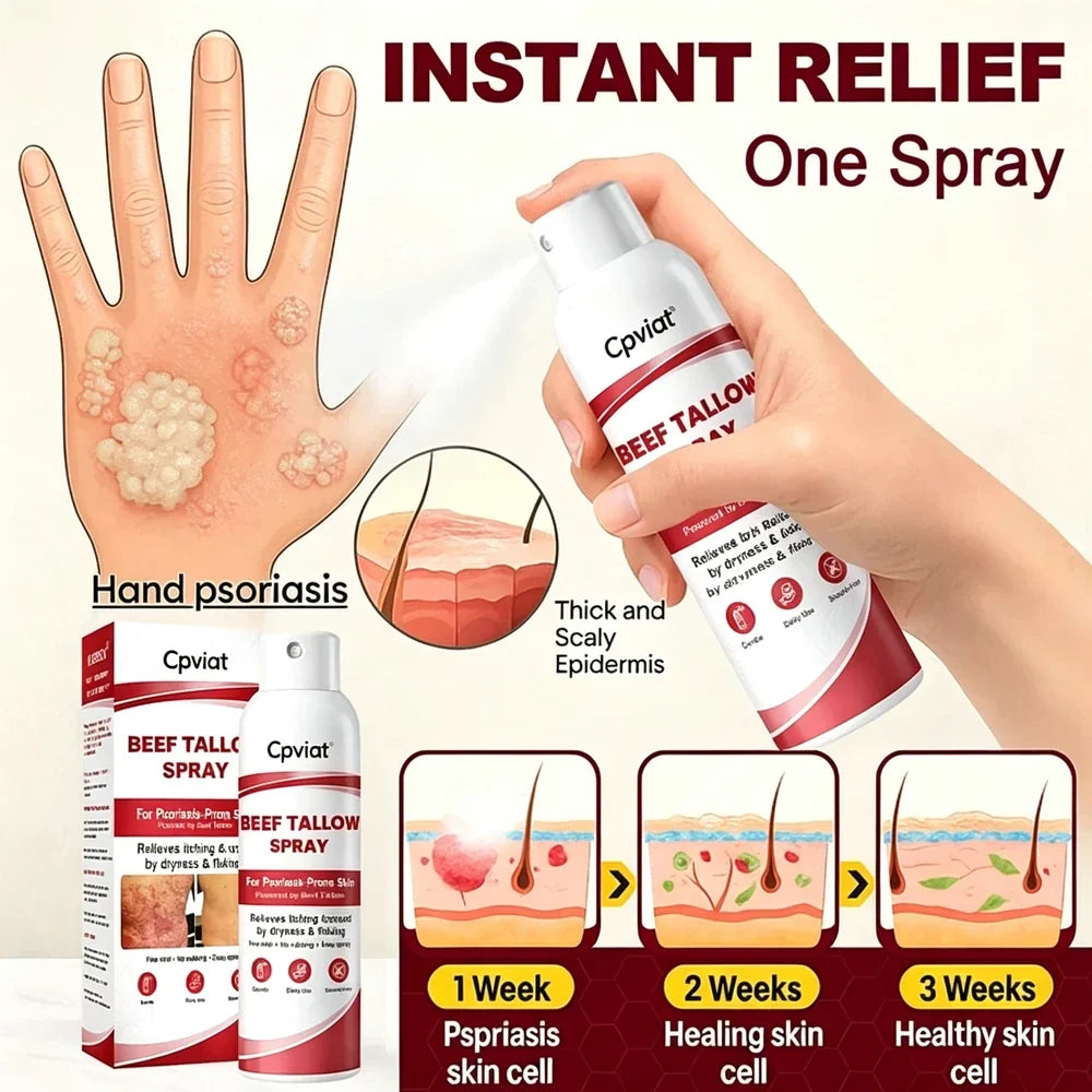 Beef Tallow Itch Relief Spray
